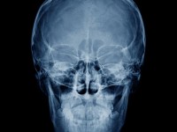 The Darkness from&nbsp;Inside